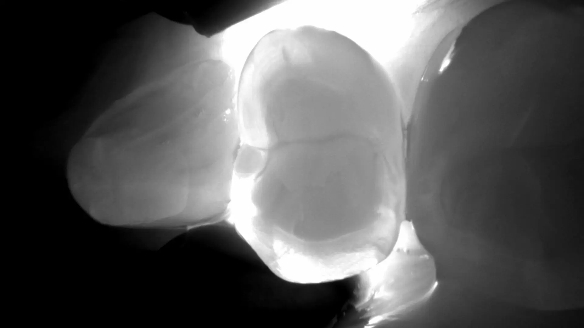 Karieserkennung ohne Röntgen mit der DIAGNOcam-Vision-Full-HD_Header-dark-V4 von KAVO