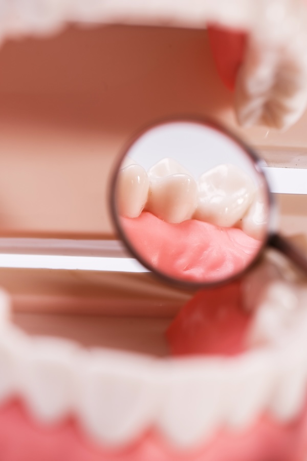 Zahnmodell mit Lupenspiegel zur Veranschaulichung der Zahnoberfläche und des Zahnfleischs – symbolisch für Prophylaxe und professionelle Zahnreinigung. Zahnerhaltung Halle – Zahnarztpraxis Dr. Michaela Strumpski.