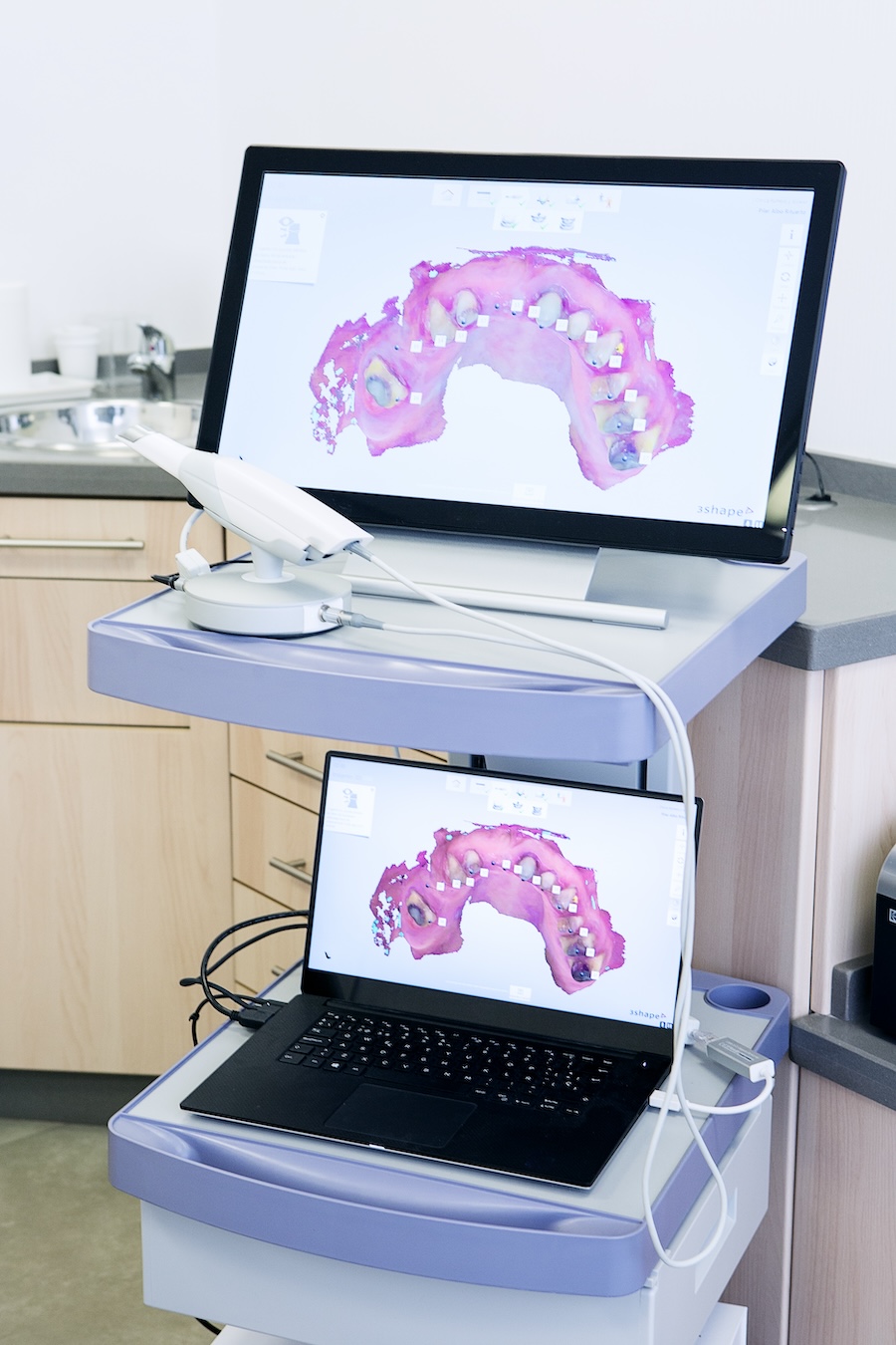 Digitale Zahnabformung mit 3D-Scanner und Visualisierung auf Monitor und Laptop. Digitaler Abdruck mit Intraoralscanner-Zahnerhaltung Halle – Zahnarztpraxis Dr. Michaela Strumpski setzt auf moderne Diagnostik.